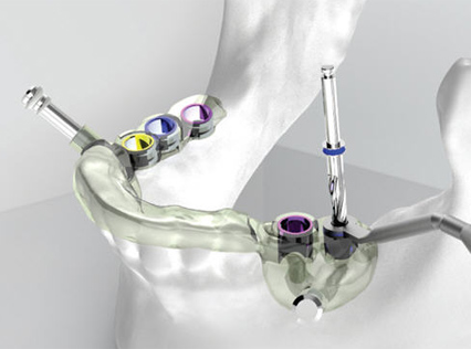 數(shù)字化種植技術(shù)