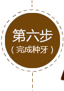 德倫數(shù)字化種植牙技術(shù)流程