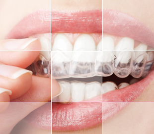 隱適美特點(diǎn)